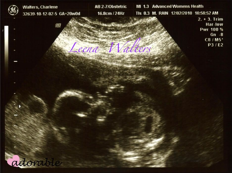 BabyLeenaWalters4-1.jpg?t=1292121583