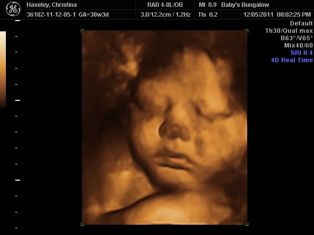 3d baby ultrasound photo: 3D Ultrasound in Buffalo, NY BabysBungalow4DVideos.jpg